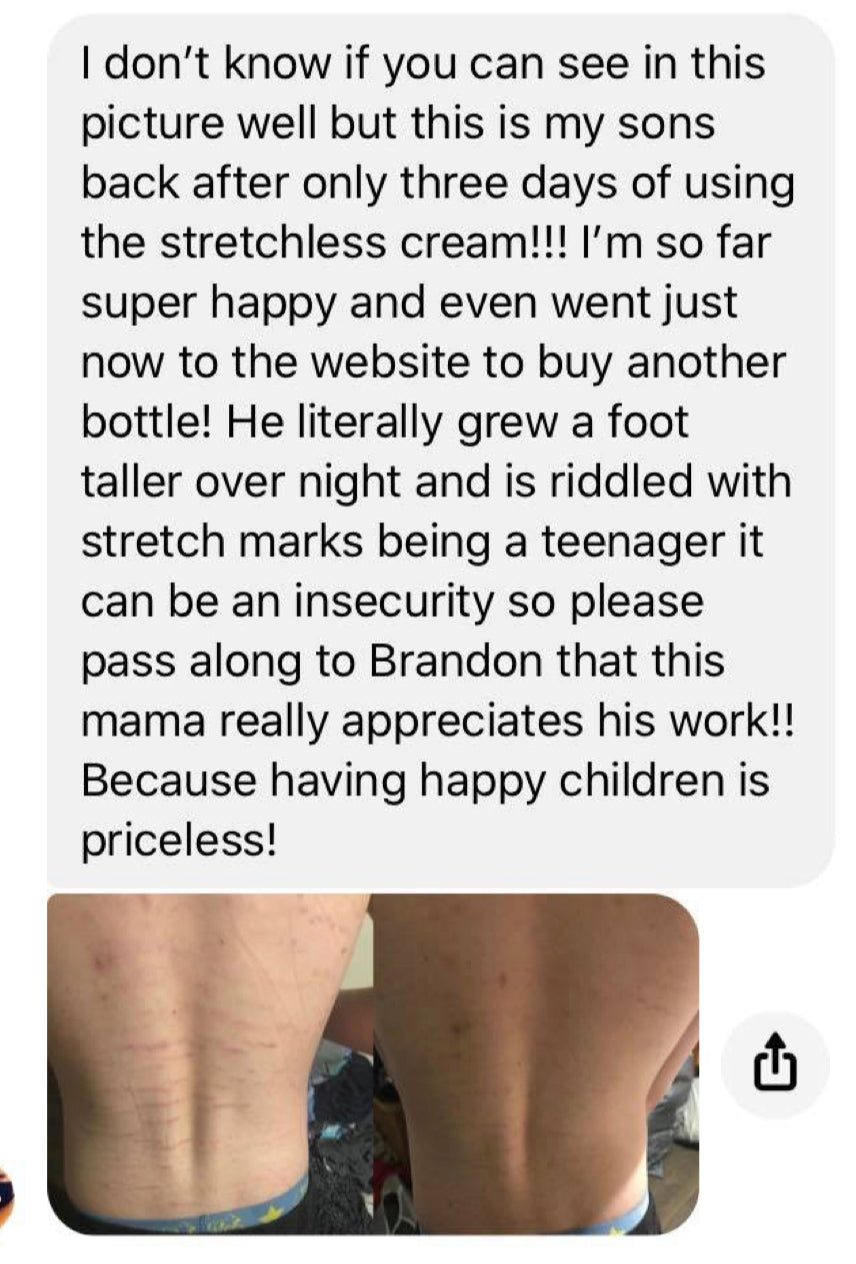 STRETCHLESS™ Stress Less Over Stress Marks!