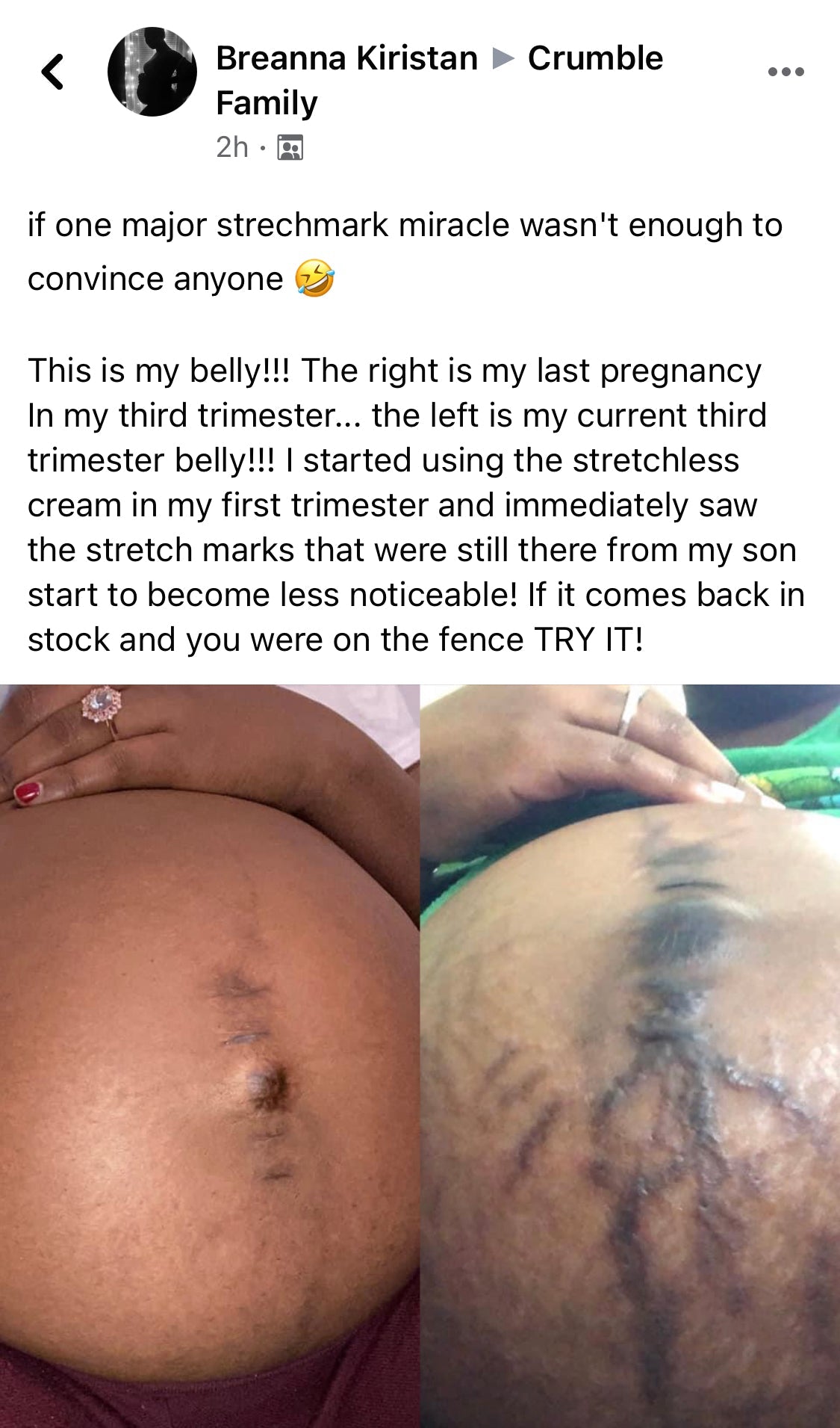 STRETCHLESS™ Stress Less Over Stress Marks!